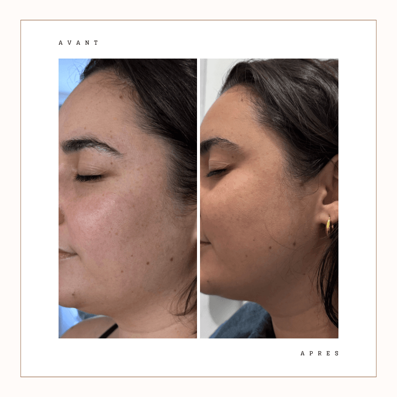 Avant après soin bronzant naturel – résultat rapide et uniforme – institut Feel Évasion Paris 2ème